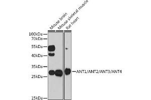 Western blot analysis of extracts of various cell lines, using /// antibody (ABIN7265627) at 1:1000 dilution. (ANT1+ANT2+ANT3+ANT4 (C-Term) Antikörper)