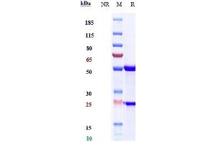 Anti-IL-6 / IFNb2 Reference Antibody (sirukumab) on SDS-PAGE under reducing (R) condition. (Rekombinanter IL6 (Sirukumab Biosimilar) Antikörper)