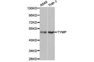 Western Blotting (WB) image for anti-Thymidine Phosphorylase (TYMP) antibody (ABIN1875239) (Thymidine Phosphorylase Antikörper)