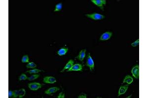 Immunofluorescent analysis of Hela cells using ABIN7146119 at dilution of 1:100 and Alexa Fluor 488-congugated AffiniPure Goat Anti-Rabbit IgG(H+L) (CXCL11 Antikörper  (AA 22-94))