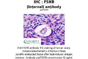 Image no. 1 for anti-Follicle Stimulating Hormone Receptor (FSHR) (Internal Region) antibody (ABIN1734475) (FSHR Antikörper  (Internal Region))