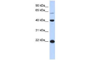 WB Suggested Anti-BLZF1 Antibody Titration: 0. (BLZF1 Antikörper  (N-Term))