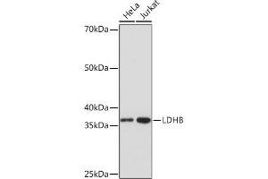 Western blot analysis of extracts of various cell lines, using LDHB Rabbit mAb (ABIN7268170) at 1:1000 dilution. (LDHB Antikörper)