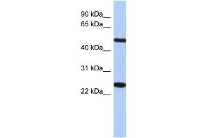 Western Blotting (WB) image for anti-Transmembrane Protein 161B (TMEM161B) antibody (ABIN2459638) (TMEM161B Antikörper)