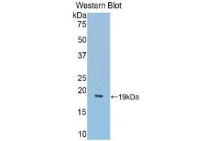 Western Blotting (WB) image for anti-Lecithin-Cholesterol Acyltransferase (LCAT) (AA 290-432) antibody (ABIN1859624)