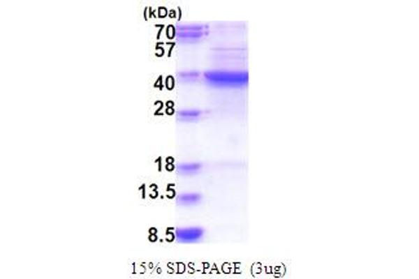 FDFT1 Protein (AA 1-283) (His tag)
