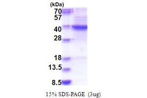 SDS-PAGE (SDS) image for Farnesyl-Diphosphate Farnesyltransferase 1 (FDFT1) (AA 1-283) protein (His tag) (ABIN5853847) (FDFT1 Protein (AA 1-283) (His tag))