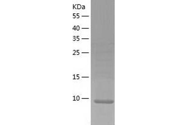 LSM3 Protein (AA 1-102) (His tag)