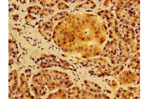 Immunohistochemistry of paraffin-embedded human pancreatic tissue using ABIN7155006 at dilution of 1:100