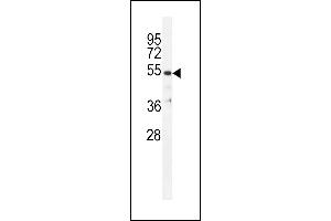 TBB1 Antibody (N-term) (ABIN655726 and ABIN2845173) western blot analysis in ZR-75-1 cell line lysates (35 μg/lane). (TUBB1 Antikörper  (N-Term))