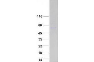 Validation with Western Blot (PDLIM7 Protein (Transcript Variant 1) (Myc-DYKDDDDK Tag))