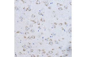 Immunohistochemistry of paraffin-embedded mouse brain using FAK Rabbit pAb (ABIN6131638, ABIN6146424, ABIN6146426 and ABIN6215254) at dilution of 1:100 (40x lens). (FAK Antikörper  (AA 425-660))