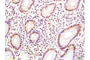 anti-Human Papilloma Virus 33 E6 (HPV-33 E6) (AA 51-149) antibody