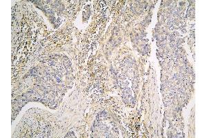 IHC analysis of PPA1 using anti-PPA1 antibody (ABIN6719527).