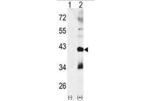 Western blot analysis of CTDSP1 (arrow) using rabbit polyclonal p38 beta Antibody (MAPK11 Antikörper  (Middle Region))