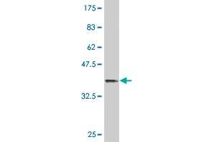 Western Blot detection against Immunogen (36. (HOXB9 Antikörper  (AA 65-163))