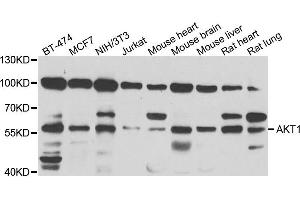 Western blot analysis of extracts of various cell lines, using AKT1 antibody. (AKT1 Antikörper)