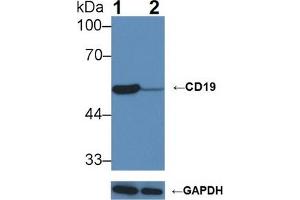 Knockout Varification: Lane 1: Wild-type Raji cell lysate; Lane 2: CD19 knockout Raji cell lysate; Predicted MW: 60kDa Observed MW: 54kDa Primary Ab: 1µg/ml Rabbit Anti-Mouse CD19 Antibody Second Ab: 0.