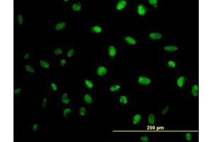 Image no. 3 for anti-N-Methylpurine-DNA Glycosylase (MPG) (AA 1-90) antibody (ABIN598820) (MPG Antikörper  (AA 1-90))