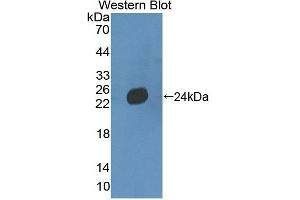 Detection of Recombinant LAMb3, Mouse using Polyclonal Antibody to Laminin Beta 3 (LAMb3) (Laminin beta 3 Antikörper  (AA 595-778))