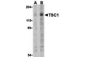 Western Blotting (WB) image for anti-Tuberous Sclerosis 1 (TSC1) (C-Term) antibody (ABIN1030780) (TSC1 Antikörper  (C-Term))