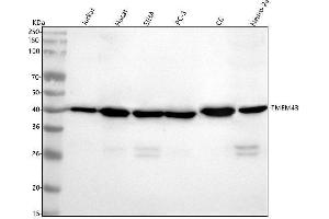 Western blot analysis of TMEM43 using anti-TMEM43 antibody (ABIN7606530).