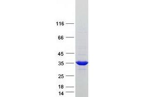 Validation with Western Blot (SULT1A4 Protein (Transcript Variant 3) (Myc-DYKDDDDK Tag))