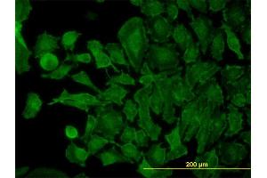 Immunofluorescence of monoclonal antibody to STX4A on HeLa cell. (Syntaxin 4 Antikörper  (AA 19-119))