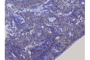 IHC analysis of NRF1 using anti-NRF1 antibody (ABIN6719347). (NRF1 Antikörper  (AA 246-503))