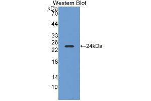 Detection of Recombinant NEIL3, Mouse using Polyclonal Antibody to Nei Endonuclease VIII Like Protein 3 (NEIL3) (NEIL3 Antikörper  (AA 2-187))