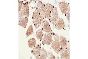 Immunohistochemical analysis of paraffin-embedded H. (SSNA1 Antikörper  (N-Term))