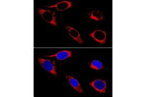 Confocal immunofluorescence analysis of U-2OS cells using P4HB antibody (ABIN3021093, ABIN3021094, ABIN3021095 and ABIN1513299) at dilution of 1:400. (P4HB Antikörper  (AA 329-508))