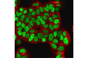 Immunofluorescence Analysis of PFA-fixed MCF-7 cells labeled with FOXA1 Mouse Monoclonal Antibody (FOXA1/1512) followed by goat anti- mouse IgG-CF488. (FOXA1 Antikörper  (AA 372-472))