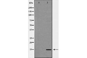 Western blot analysis of extracts of HeLa, using H3K14me3 antibody. (Histone 3 Antikörper  (H3K14me3))