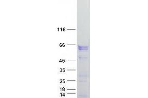 Western Blotting (WB) image for Forkhead Box C2 (MFH-1, Mesenchyme Forkhead 1) (FOXC2) protein (Myc-DYKDDDDK Tag) (ABIN2721343)