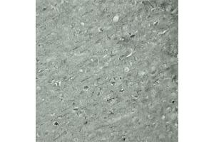 IHC on mouse brain (cryo section) using Rabbit antibody to Synaptotagmin 17  at a concentration of 50 µg/ml incubated overnight at 4C. (SYT17 Antikörper  (Internal Region))