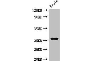 Western Blot Positive WB detected in: Mouse brain tissue All lanes: RNF126 antibody at 2. (RNF126 Antikörper  (AA 39-225))