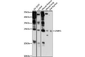 Western blot analysis of extracts of various cell lines, using ZNRF1 antibody (ABIN7271433) at 1000 dilution. (ZNRF1 Antikörper  (AA 1-170))