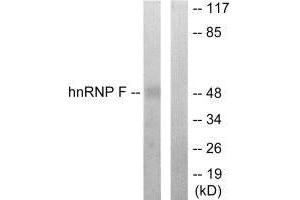 Western blot analysis of extracts from HepG2 cells, using hnRNP F antibody. (HNRNPF Antikörper  (N-Term))