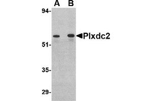 Western Blotting (WB) image for anti-Plexin Domain Containing 2 (PLXDC2) (C-Term) antibody (ABIN1030593) (PLXDC2 Antikörper  (C-Term))