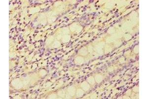 Immunohistochemistry of paraffin-embedded human colon tissue using ABIN7149359 at dilution of 1:100 (BMX Antikörper  (AA 65-280))