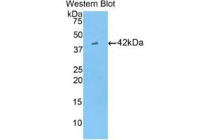 Western blot analysis of the recombinant protein. (CKB Antikörper  (AA 11-367))