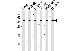 Western blot analysis of lysates from Hela cell line, mouse brain, mouse testis, mouse lung, mouse spleen, rat brain tissue (from left to right), using Mouse Cbx7 Antibody (C-term) (ABIN6243434 and ABIN6577610). (CBX7 Antikörper  (C-Term))