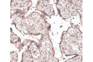 Immunohistochemistry of paraffin-embedded Human placenta using CCNE2 Polyclonal Antibody at dilution of 1:100 (40x lens). (Cyclin E2 Antikörper)