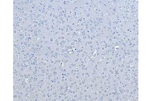 IHC analysis of B Raf/BRAF using anti-B Raf/BRAF antibody (ABIN3043761). (BRAF Antikörper  (AA 38-230))
