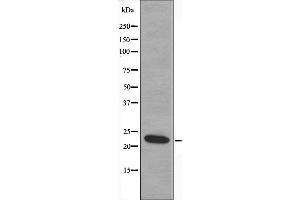 Western blot analysis of extracts from NIH-3T3 cells, using Recoverin antibody. (Recoverin Antikörper  (Internal Region))