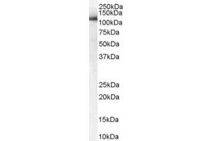 Western Blotting (WB) image for anti-USO1 Homolog, Vesicle Docking Protein (USO1) (AA 961-972) antibody (ABIN297849) (USO1 Antikörper  (AA 961-972))