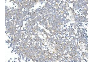 IHC analysis of DDIT3 using anti-DDIT3 antibody (ABIN7599026).