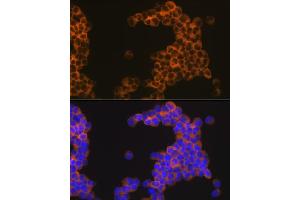 Immunofluorescence (IF) image for anti-Tumor Necrosis Factor Receptor Superfamily, Member 8 (TNFRSF8) antibody (ABIN7271072)
