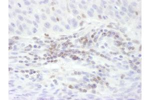 Immunohistochemistry (IHC) image for anti-Signal Transducer and Activator of Transcription 5B (STAT5B) (AA 737-787) antibody (ABIN7453649)